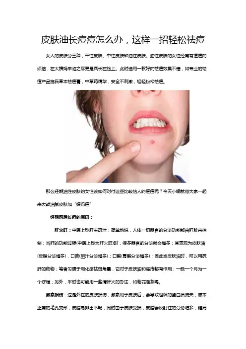 皮肤油长痘痘怎么办,这样一招轻松祛痘
