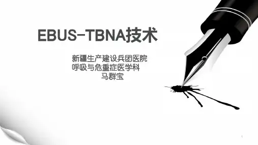 EBUS-TBNA操作流程(1)ppt课件