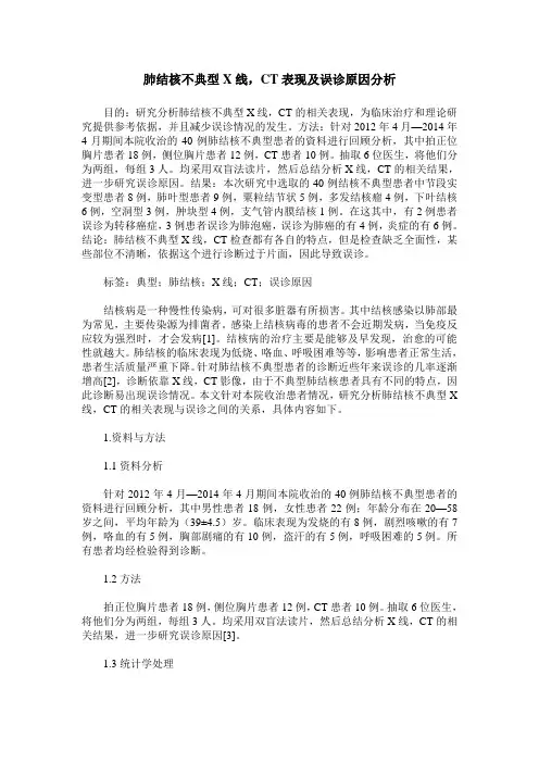 肺结核不典型X线,CT表现及误诊原因分析