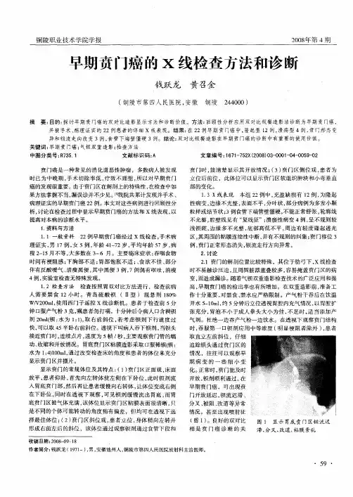 早期贲门癌的X线检查方法和诊断