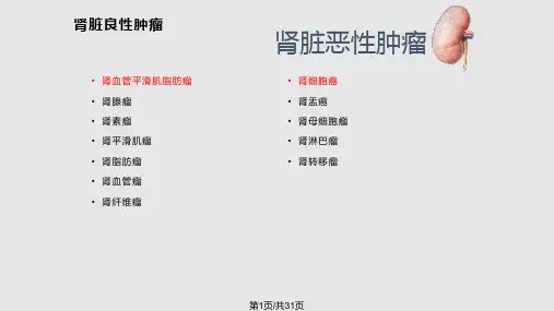 肾脏良恶性肿瘤影像表现详解PPT课件