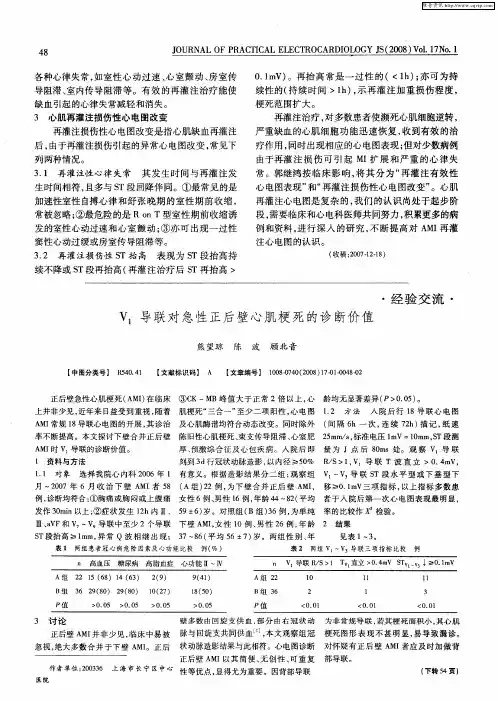 V1导联对急性正后壁心肌梗死的诊断价值