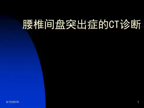 椎间盘突出症的ct表现 ppt课件