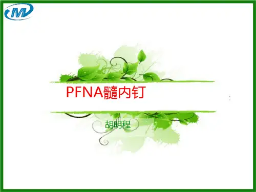 PFNA髓内钉