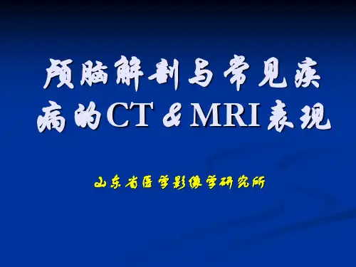 颅脑解剖与常见疾病的CTMRI表现 PPT资料共146页