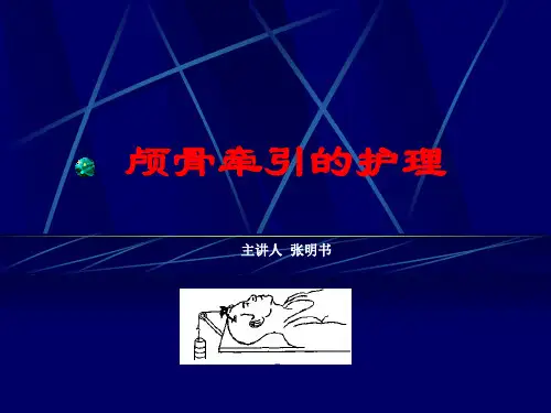 颅骨牵引术