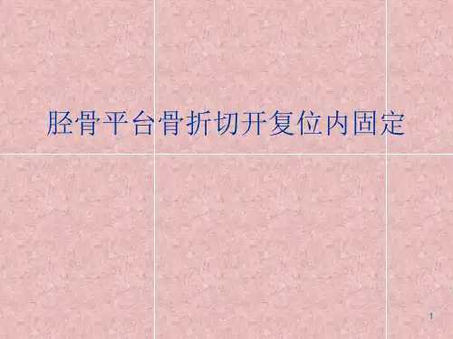 胫骨平台切开复位内固定的手术配合-PPT课件