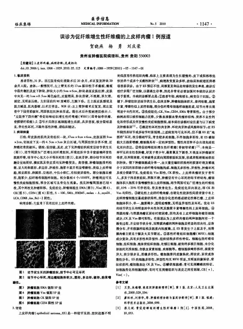 误诊为促纤维增生性纤维瘤的上皮样肉瘤1例报道
