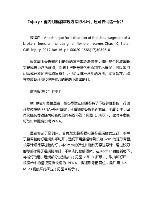 Injury：髓内钉断裂常规方法取不出，还可尝试这一招！