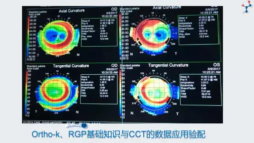 Ortho-k、RGP基础知识与CCT的数据应用验配 聂奇林