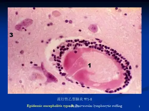 病理切片图片大全  ppt课件