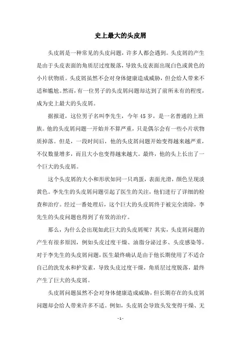 史上最大的头皮屑