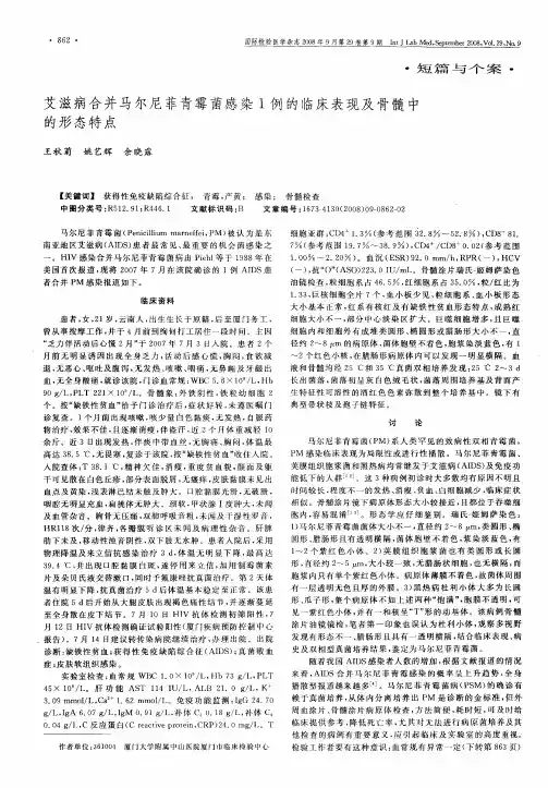 艾滋病合并马尔尼菲青霉菌感染1例的临床表现及骨髓中的形态特点