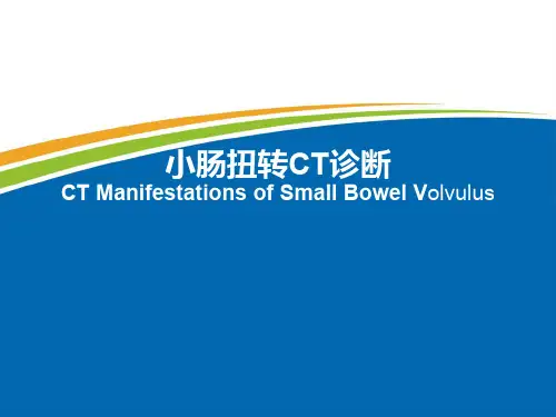 小肠扭转CT诊断