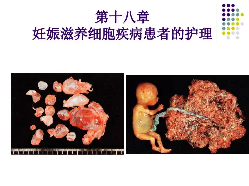 妇产科护理学_课程课件_18.妊娠滋养细胞疾病患者的护理