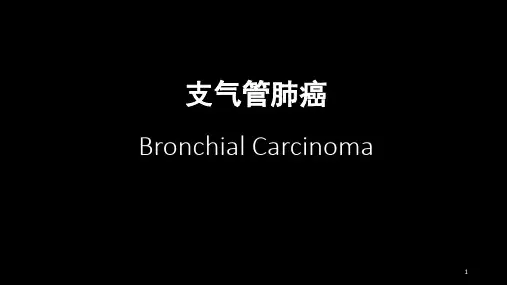 支气管肺癌PPT参考课件