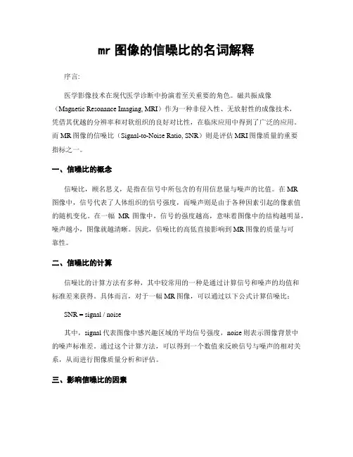 mr图像的信噪比的名词解释
