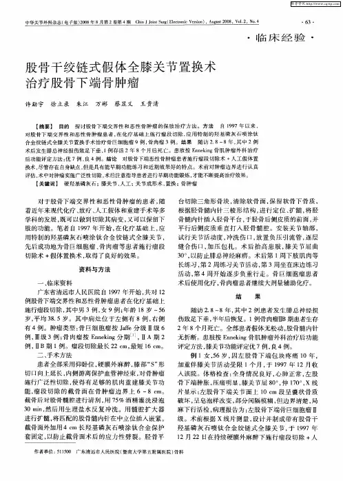 股骨干绞链式假体全膝关节置换术治疗股骨下端骨肿瘤