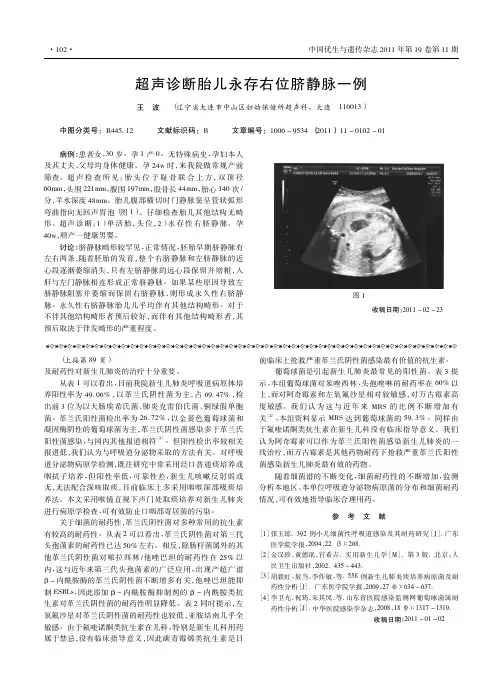 超声诊断胎儿永存右位脐静脉一例
