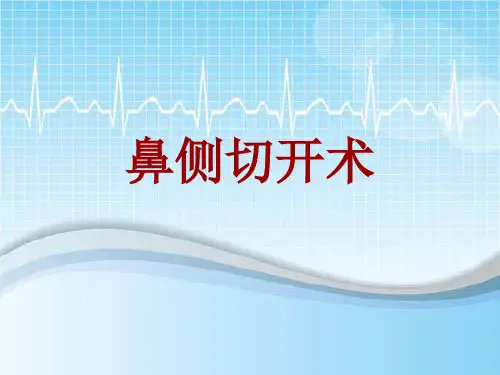 手术讲解模板：鼻侧切开术