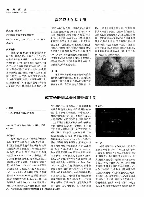 超声诊断卵巢囊性畸胎瘤1例