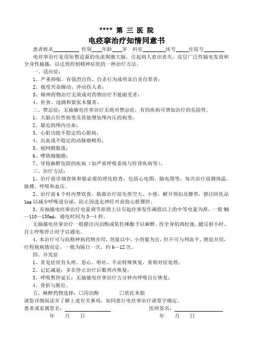 MECT知情同意书