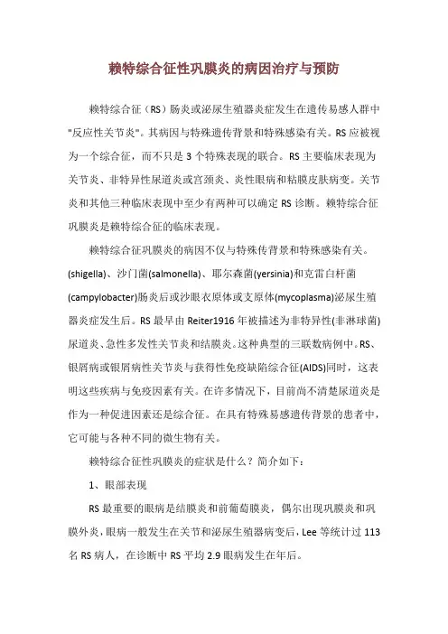 赖特综合征性巩膜炎的病因治疗与预防
