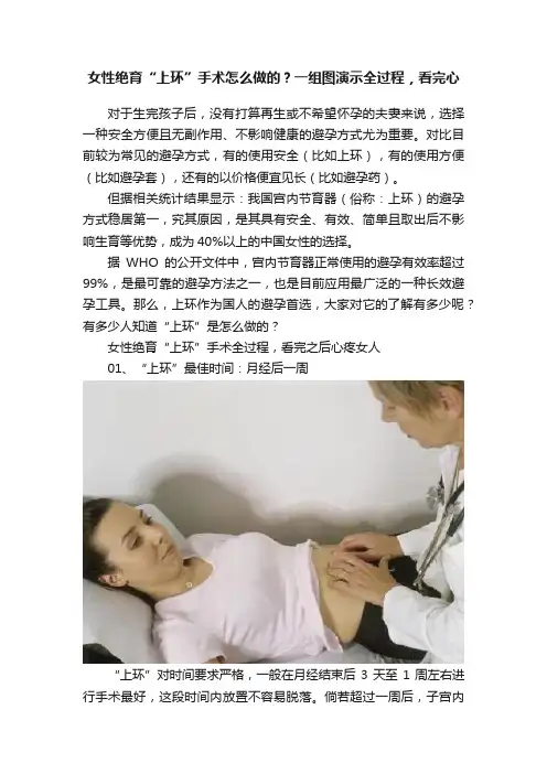 女性绝育“上环”手术怎么做的？一组图演示全过程，看完心