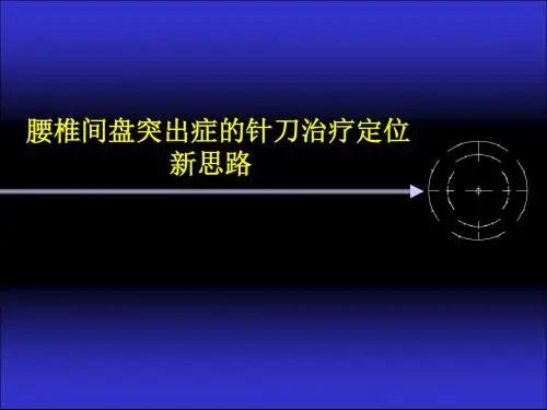 腰椎间盘突出症的针刀治疗定点思路