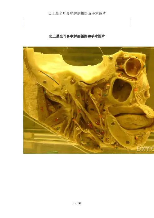 史上最全耳鼻喉解剖摄影及手术图片