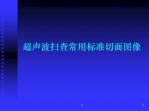 超声常用标准切面