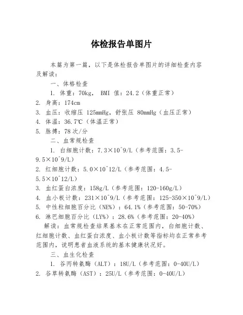 体检报告单图片