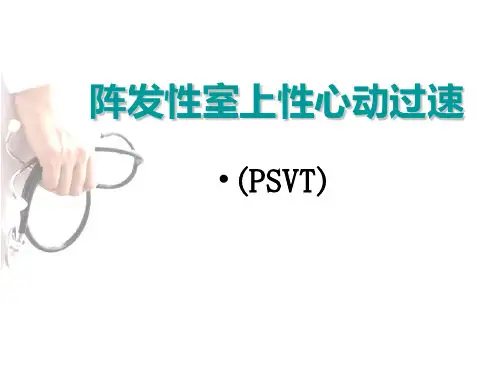 室上性心动过速 医学课件