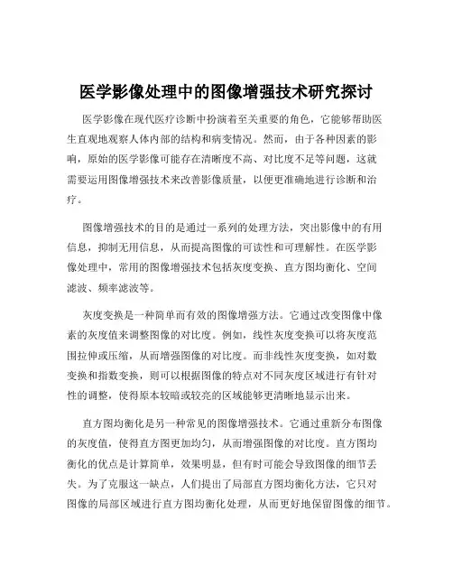 医学影像处理中的图像增强技术研究探讨