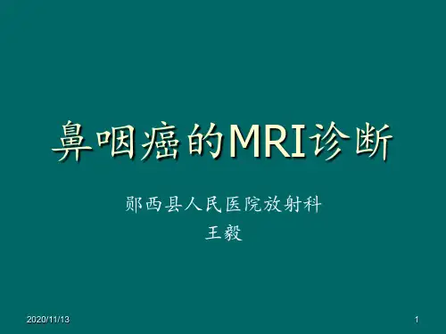 鼻咽癌的MRI诊断 ppt课件