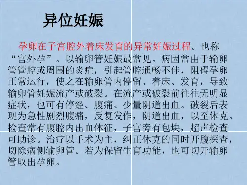 异位妊娠的诊断要点