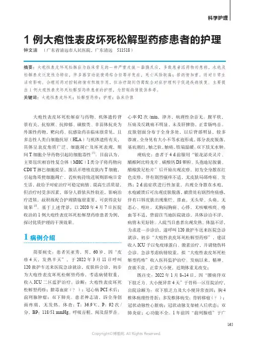211208724_1例大疱性表皮坏死松解型药疹患者的护理