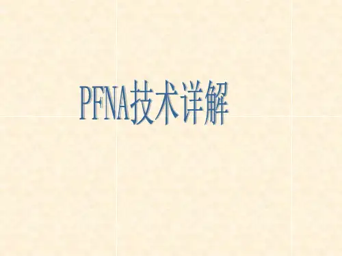 PFNA技术详解