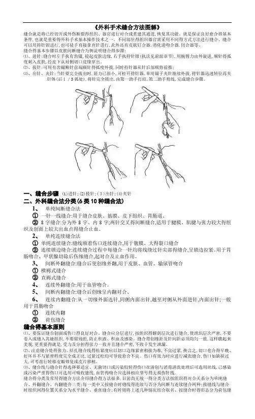 《手术缝合方法分类图解》