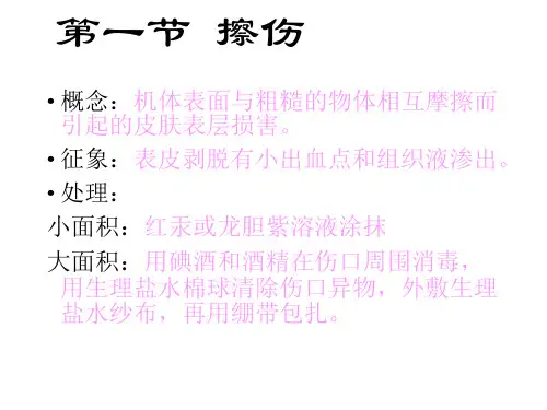 常见运动损伤讲义精品PPT课件