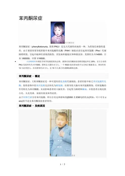苯丙酮尿症
