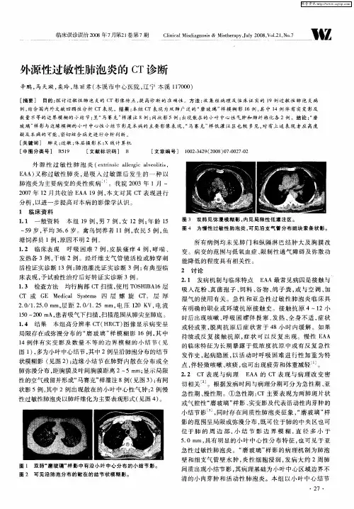外源性过敏性肺泡炎的CT诊断