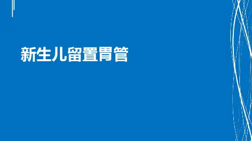 新生儿留置胃管