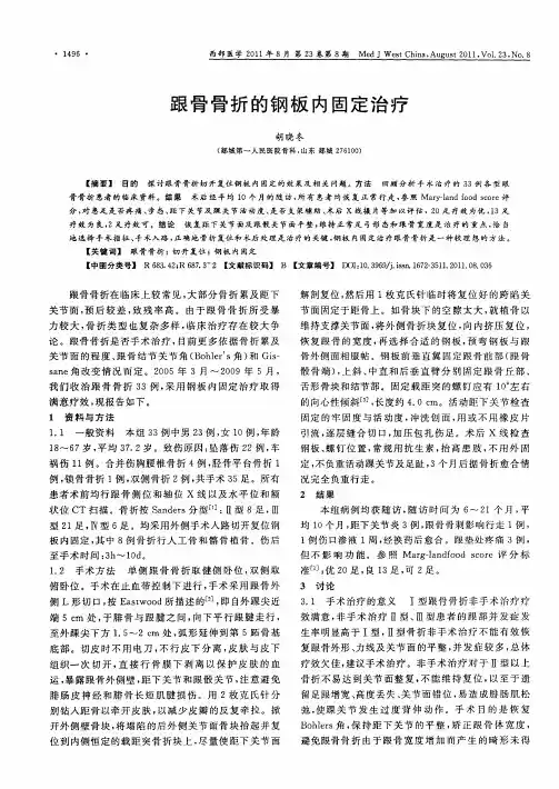 跟骨骨折的钢板内固定治疗