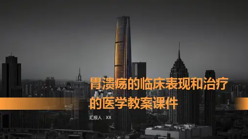 胃溃疡的临床表现和治疗的医学教案课件