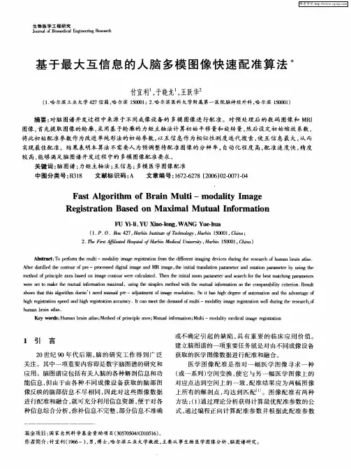 基于最大互信息的人脑多模图像快速配准算法