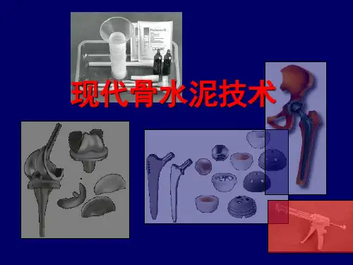 骨水泥技术ppt课件