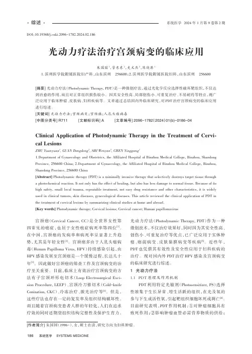 光动力疗法治疗宫颈病变的临床应用