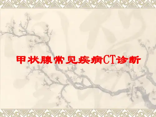 甲状腺常见疾病CT诊断培训课件