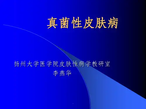 真菌性皮肤病ppt课件